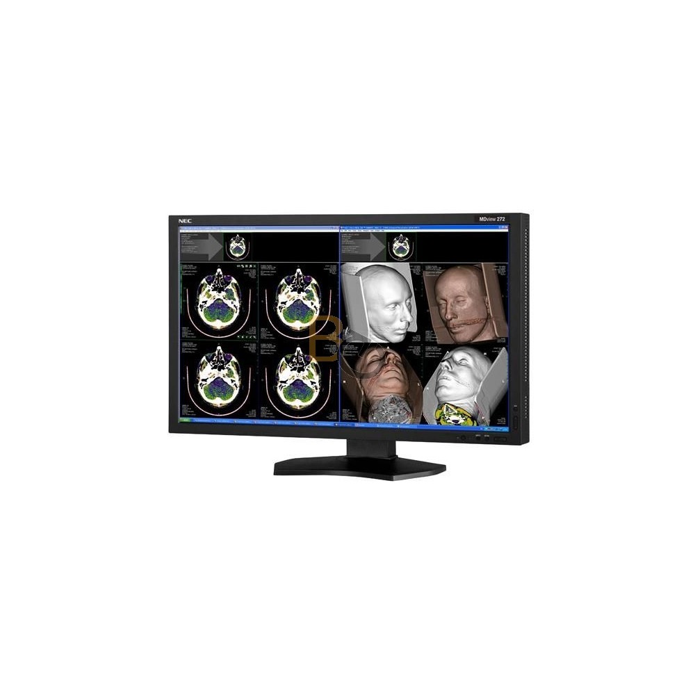 Monitor NEC MDview 272